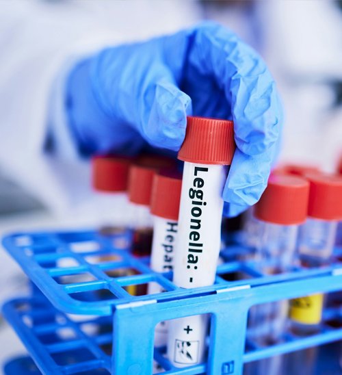 Preparing for a Legionella Risk Assessment 02